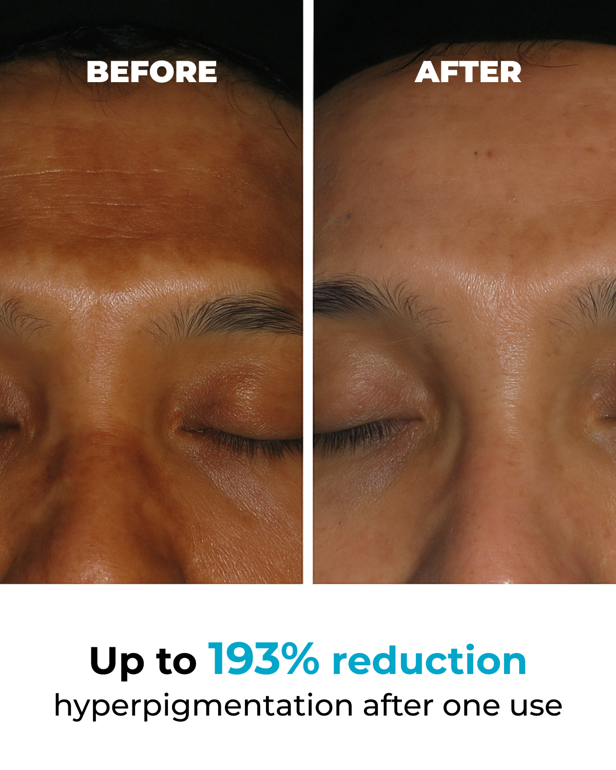 Poción Corporal Viral Jelly Booster para Pigmentación